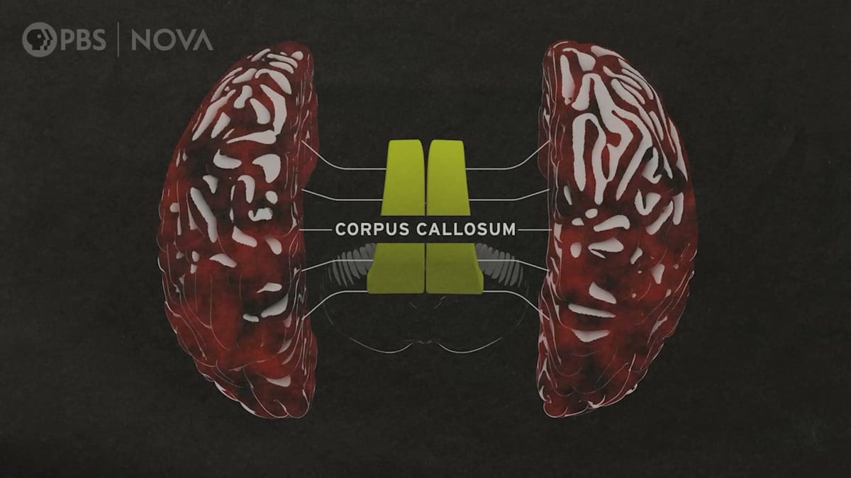 consciousness and brain communication video still: The corpus callosum connects the two hemispheres of the brain